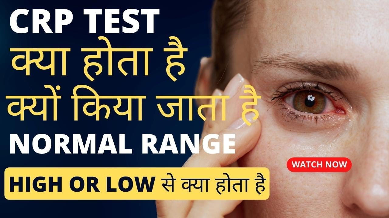 CRP test kya hota hai | crp test in hindi | crp test normal range | crp high hone se kya hota hai