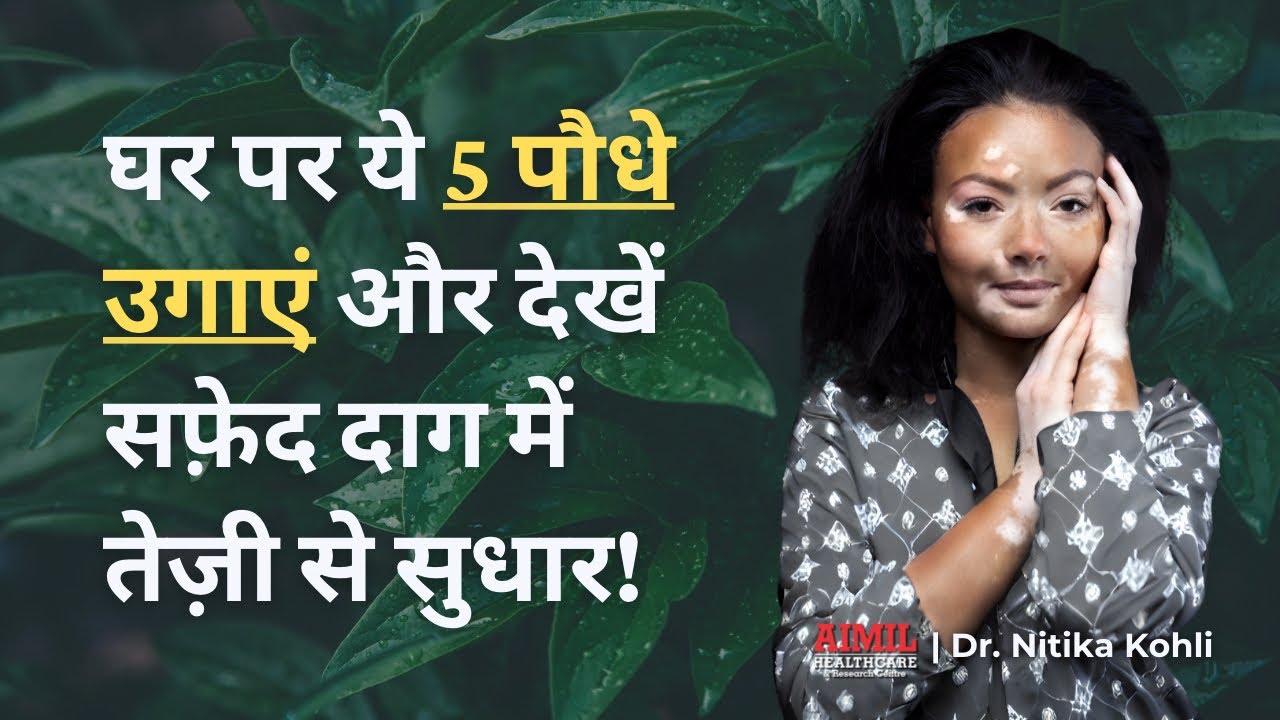 Grow These 5 Plants At Home For Faster Vitiligo Recovery!