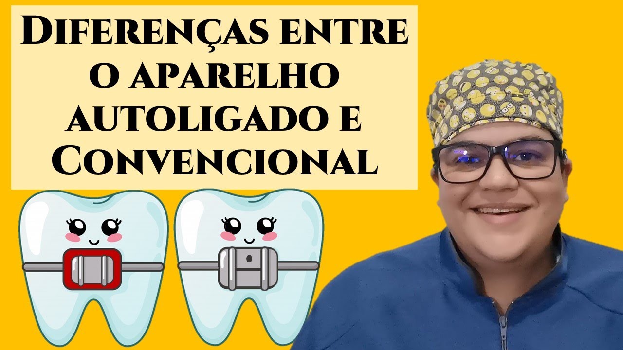 Diferenças entre o tratamento de aparelhos convencionais e autoligado.|Dra Bianca Rosa
