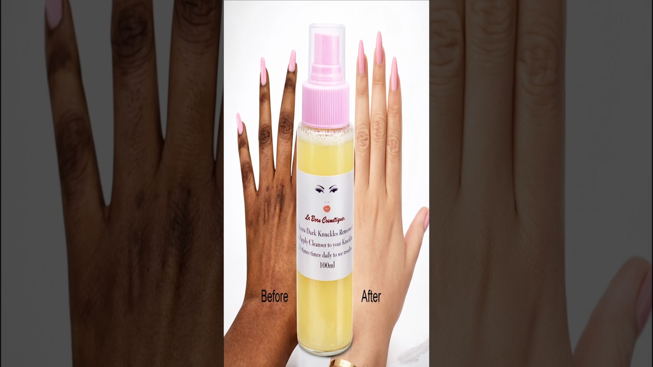 I Tried This on My Dark Knuckles… The Results Shocked Me 😳