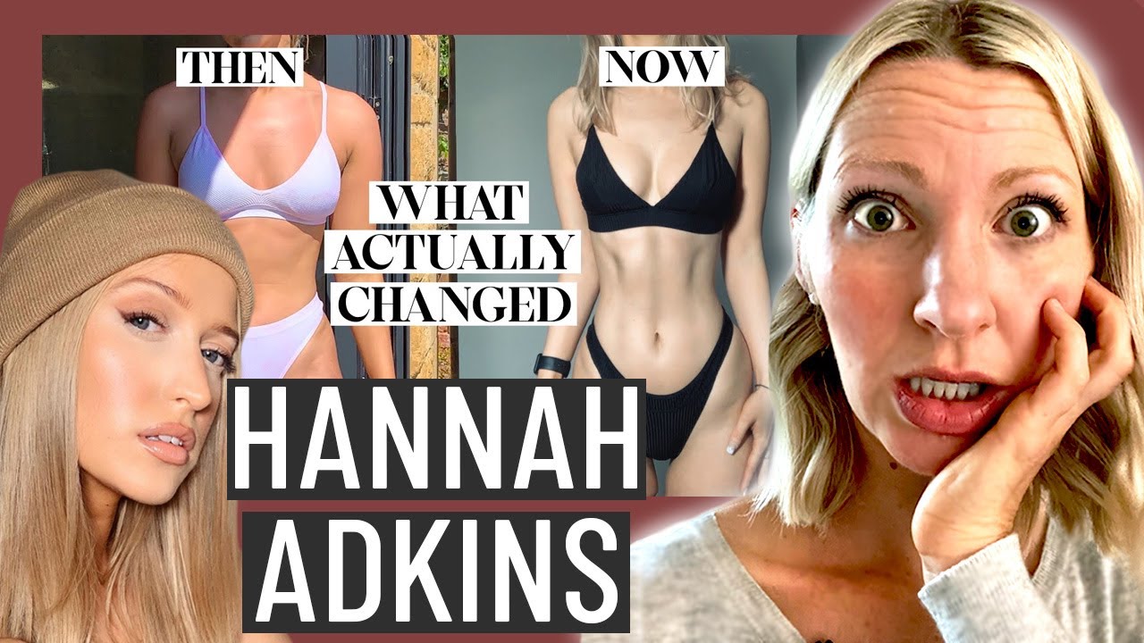 Dietitian Reviews Hannah Adkin's Tips for Losing Fat (Yikes... be careful what 