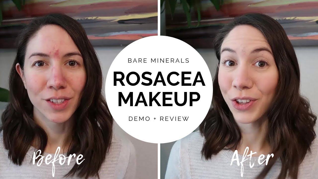 Bare Minerals for Rosacea // Demo + Review