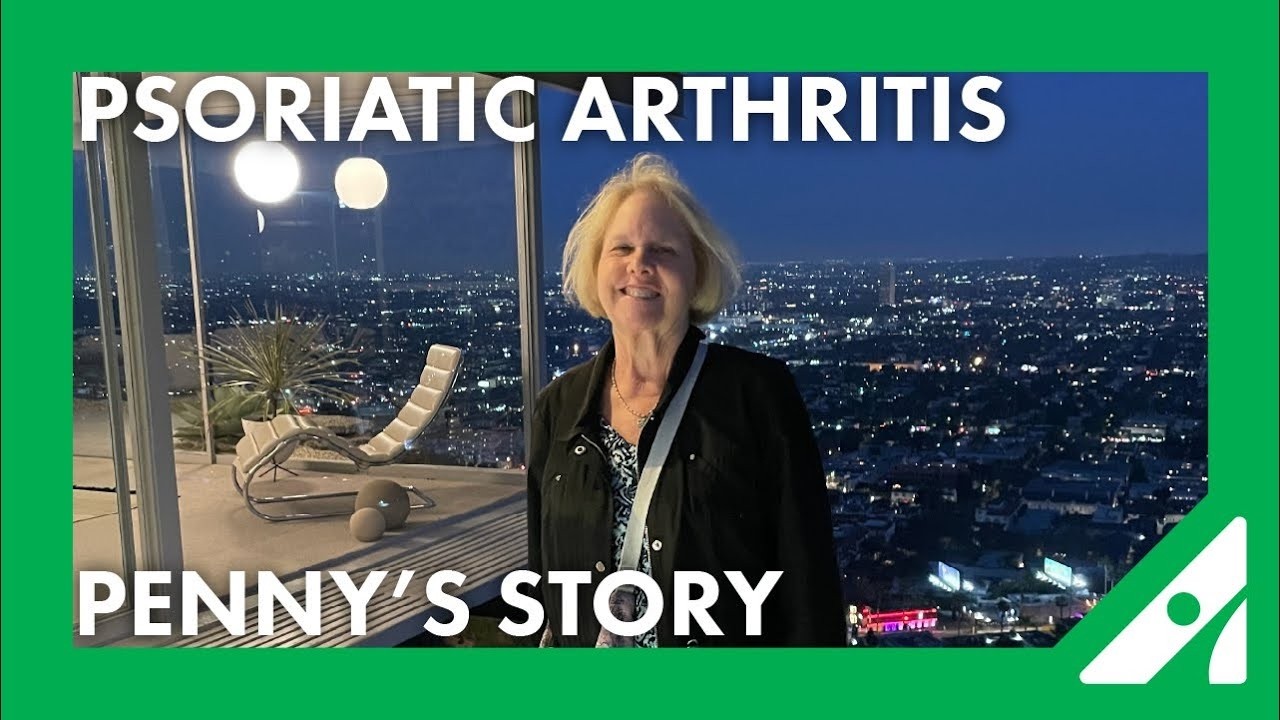 When Psoriasis Could be Psoriatic Arthritis