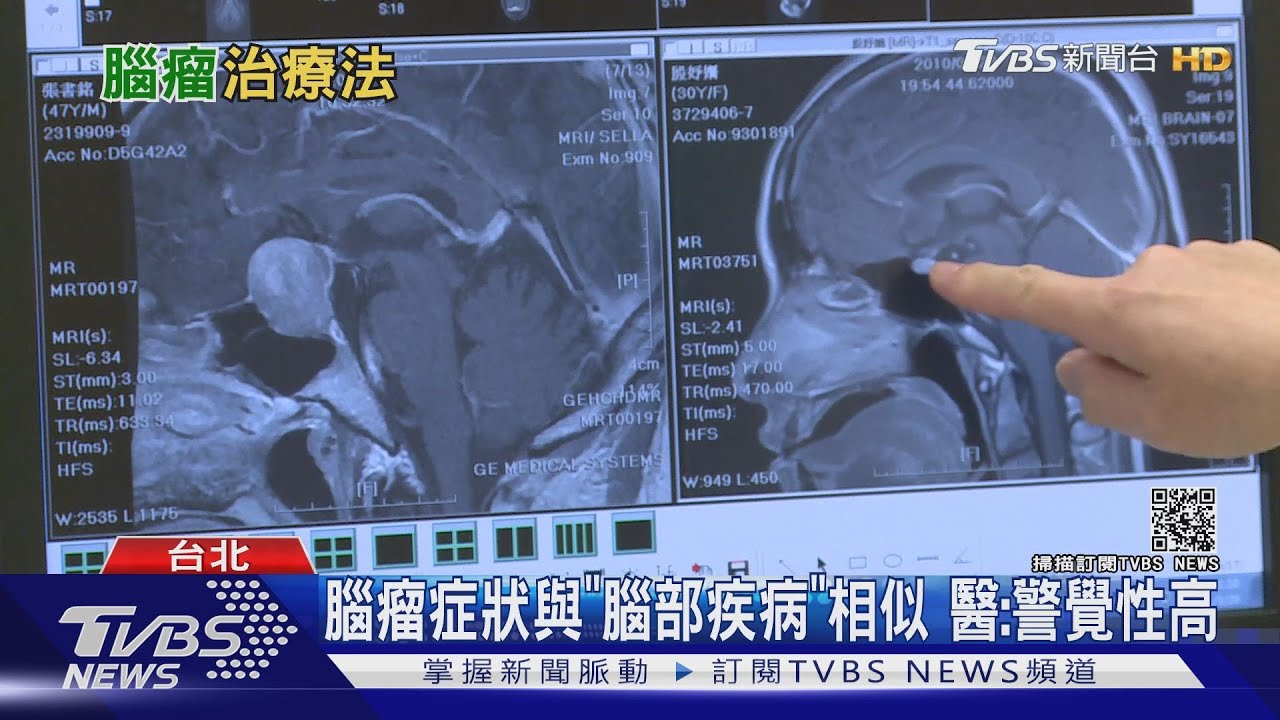 輕忽