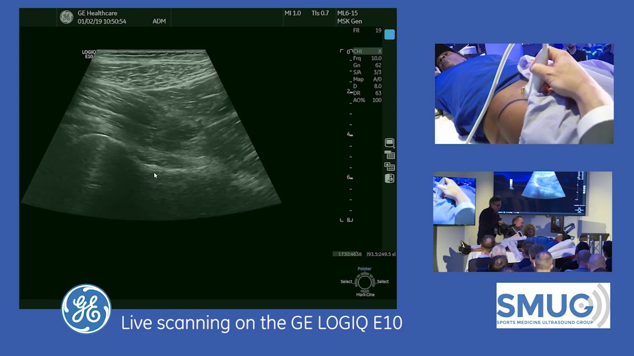 SMUG Jon Jacobson Masterclass 2019.  Hip and Groin Demonstration