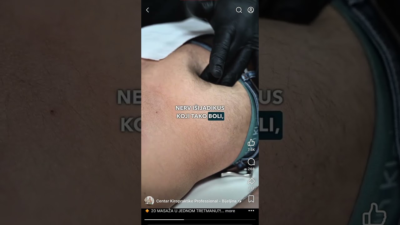 Dry needling - Medicinska akupunktura & kiropraktika