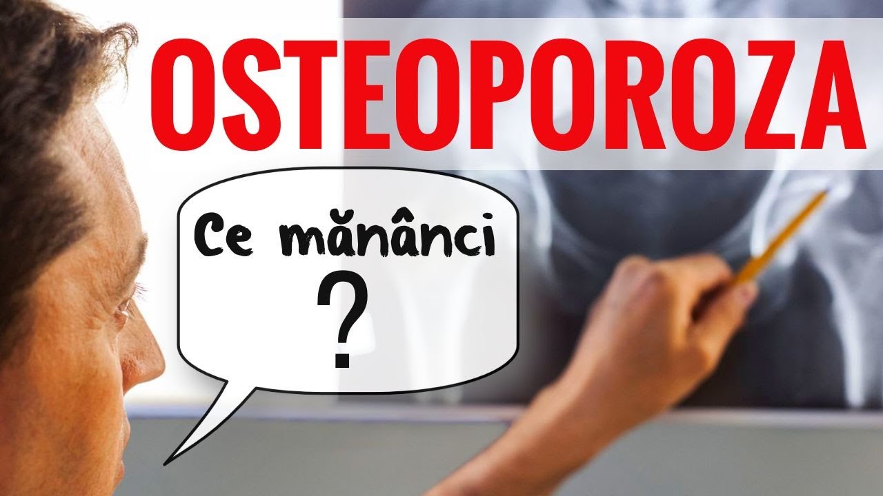 OSTEOPOROZA. Ce dietă te ajută să o previi?