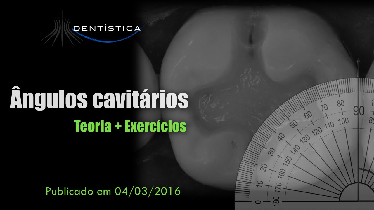 Ângulos Cavitários (Teoria + Exercícios)