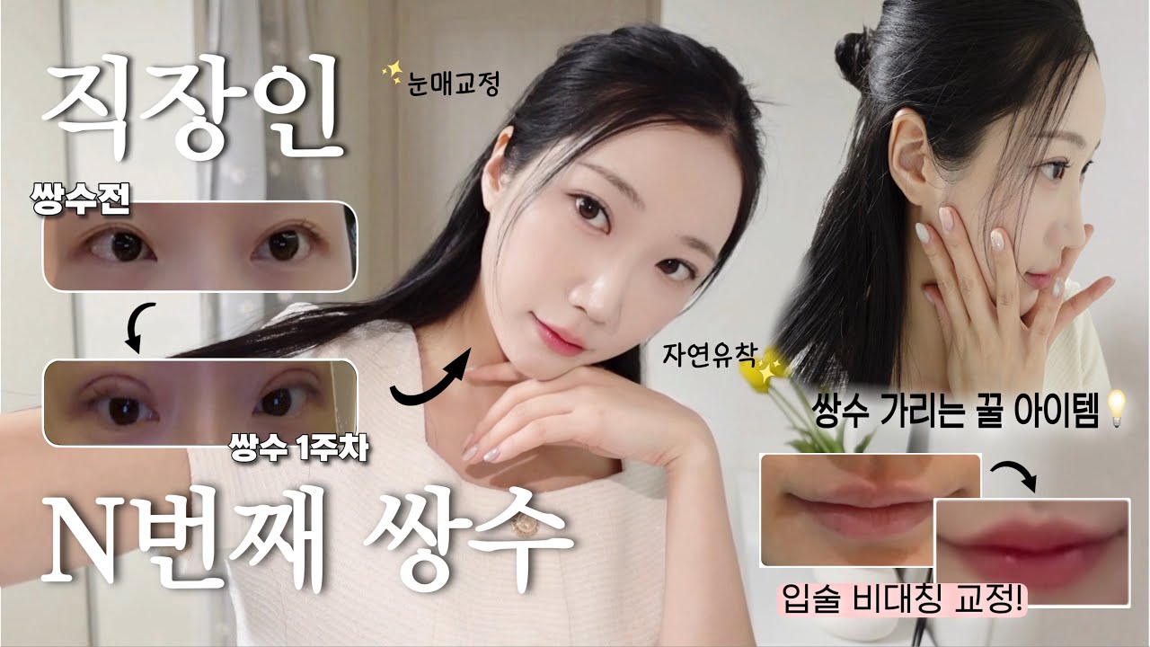 직장인 쌍수 브이로그 .zip | 매몰(세미아웃)+비절개 눈매교정 한달차 후기 1일차~5주차 솔직리뷰👀•직장인 뷰티데이•관리의달