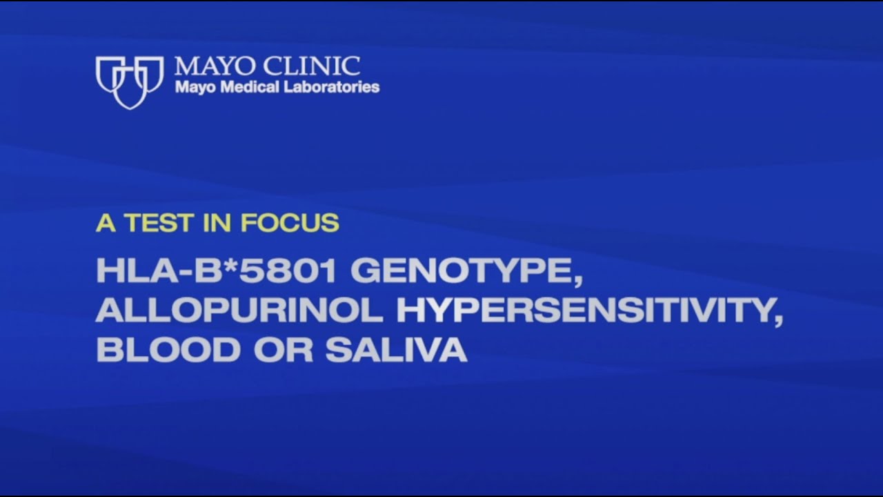 A Test in Focus: HLA-B*5801 Genotype. Allopurinol Hypersensitivity