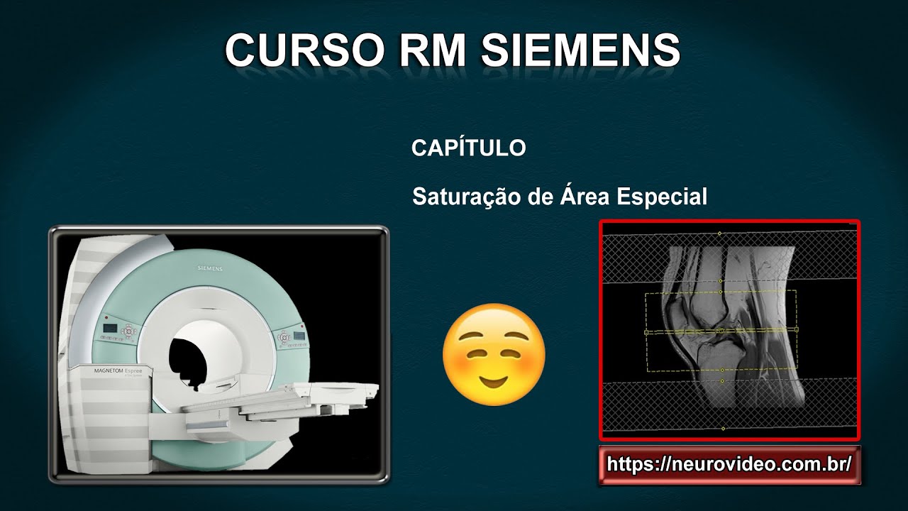 Ressonância Magnética Siemens