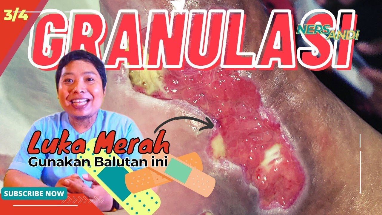 Luka Merah Gampang Berdarah, gunakan verban ini ‼️ #balutanluka #perawatanluka #granulasi