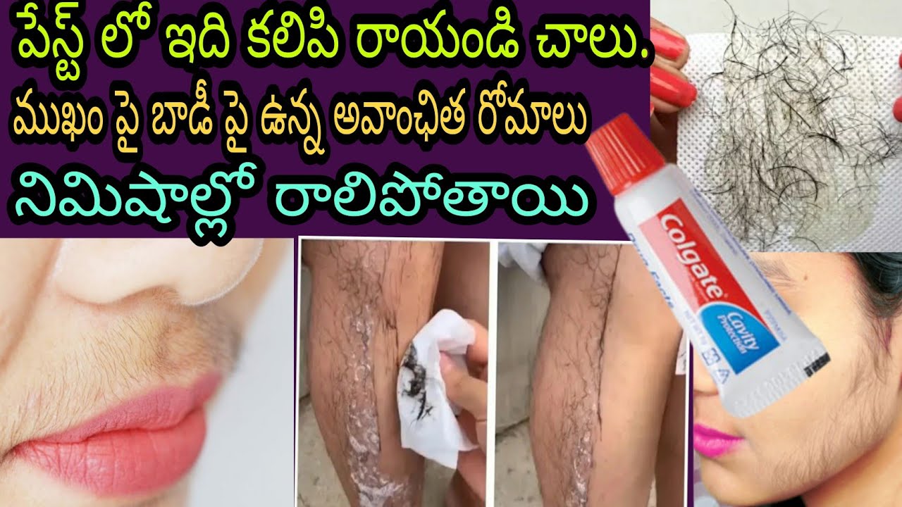 How To Remove Unwanted HairbPermanetly In Telugu| Remove Facial Hair Naturally In Just 4 Ingredients