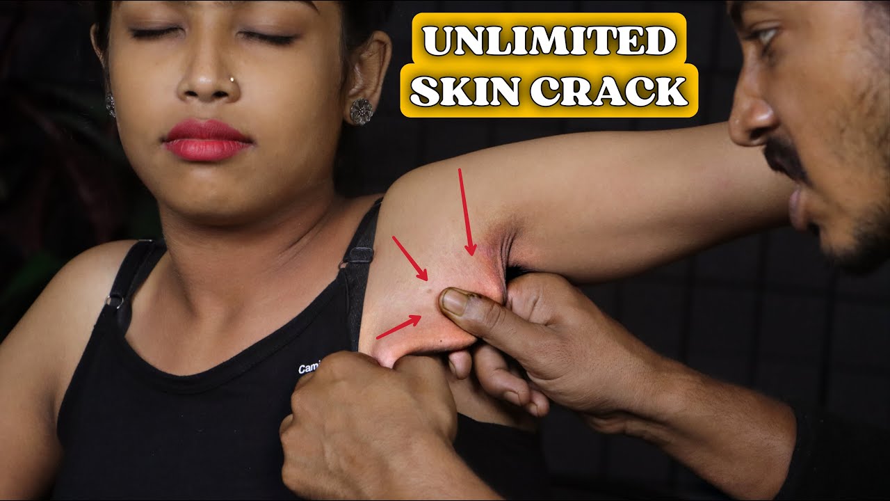 Unlimited Skin Cracking | Girl Received Body Massage | Thai Massage | ASMR #insomnia #anxiety