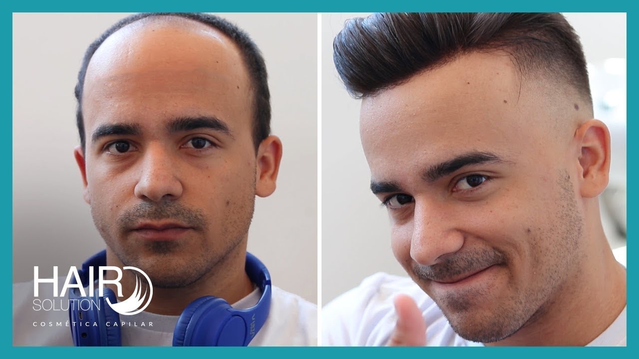 Undetectable hair prosthesis / Non-surgical hair replacement system