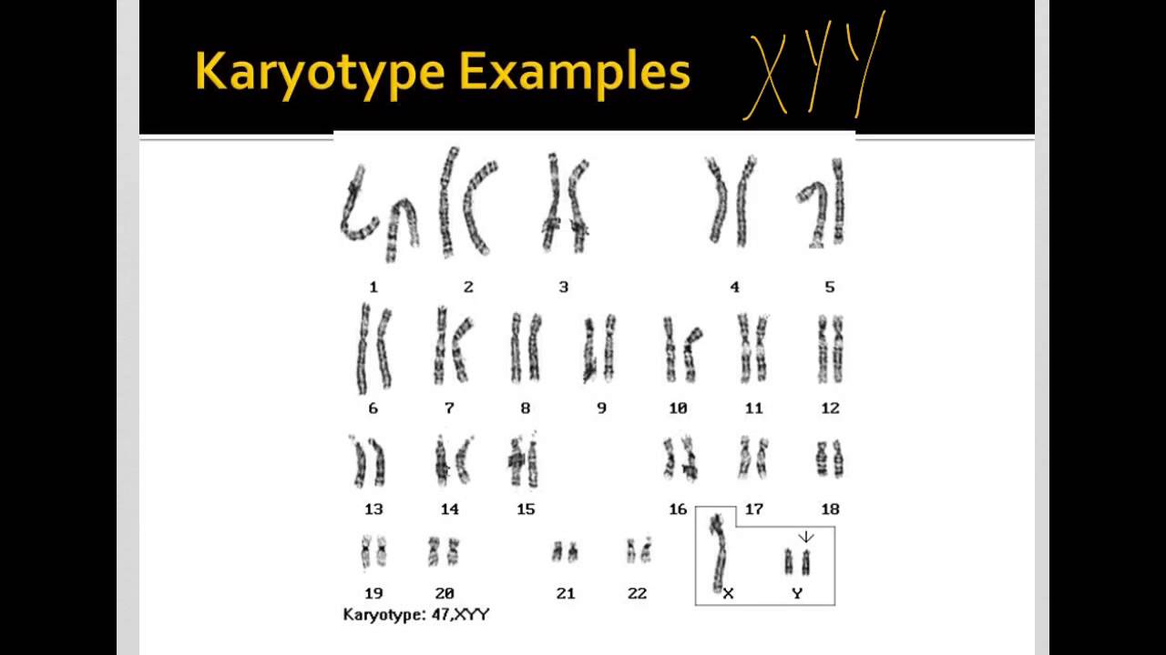 Human Trisomies