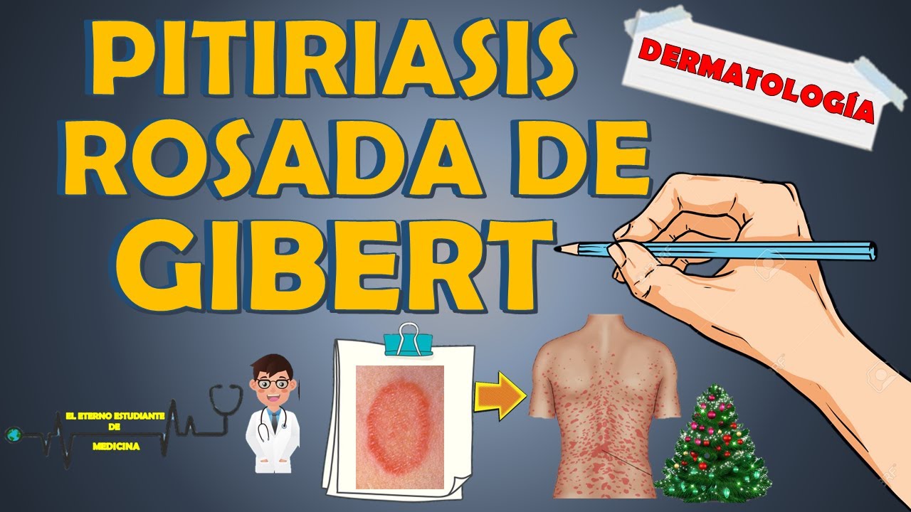 PITIRIASIS ROSADA DE GIBERT ( GILBERT ) - ¿cuánto dura?, clínica, tratamiento📝👨🏻‍⚕️EXPLICACIÓN FÁCIL