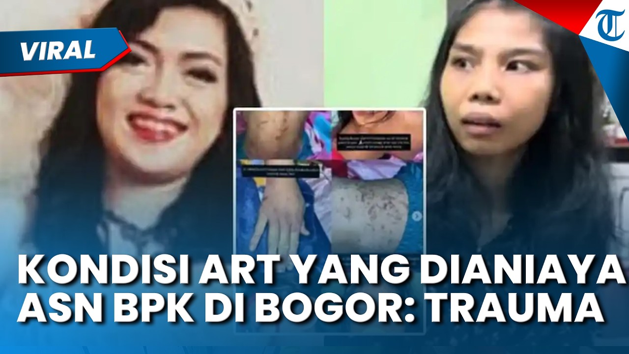 TRAUMA BERAT! Begini Kondisi ART yang Dianiaya ASN BPK Olfit di Bogor: Pemulihan Luka Sekujur Tubuh