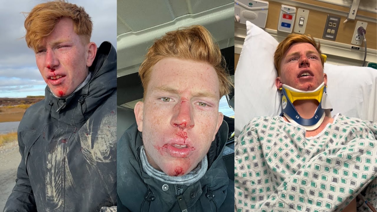 Ginger survived deadly atv crash in alaska (concussion, fracture, survival)