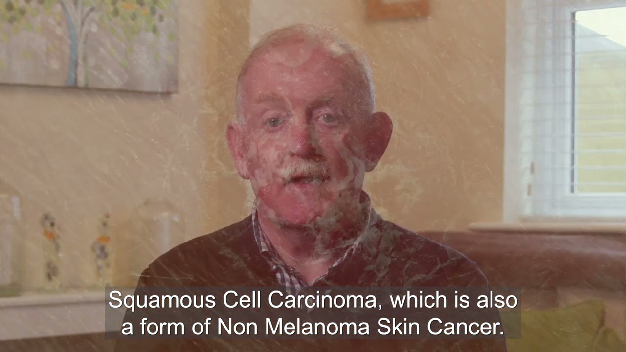 SunSmart Patient Skin Cancer Story, Martin's Story (Full Version)