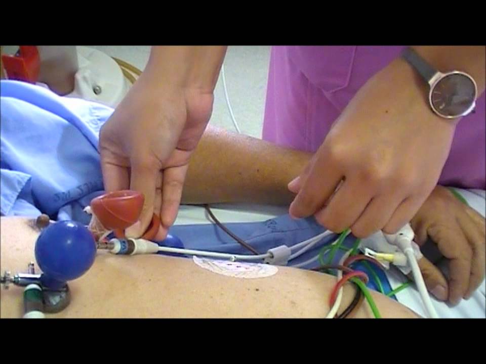 คลื่นไฟฟ้าหัวใจ.wmv