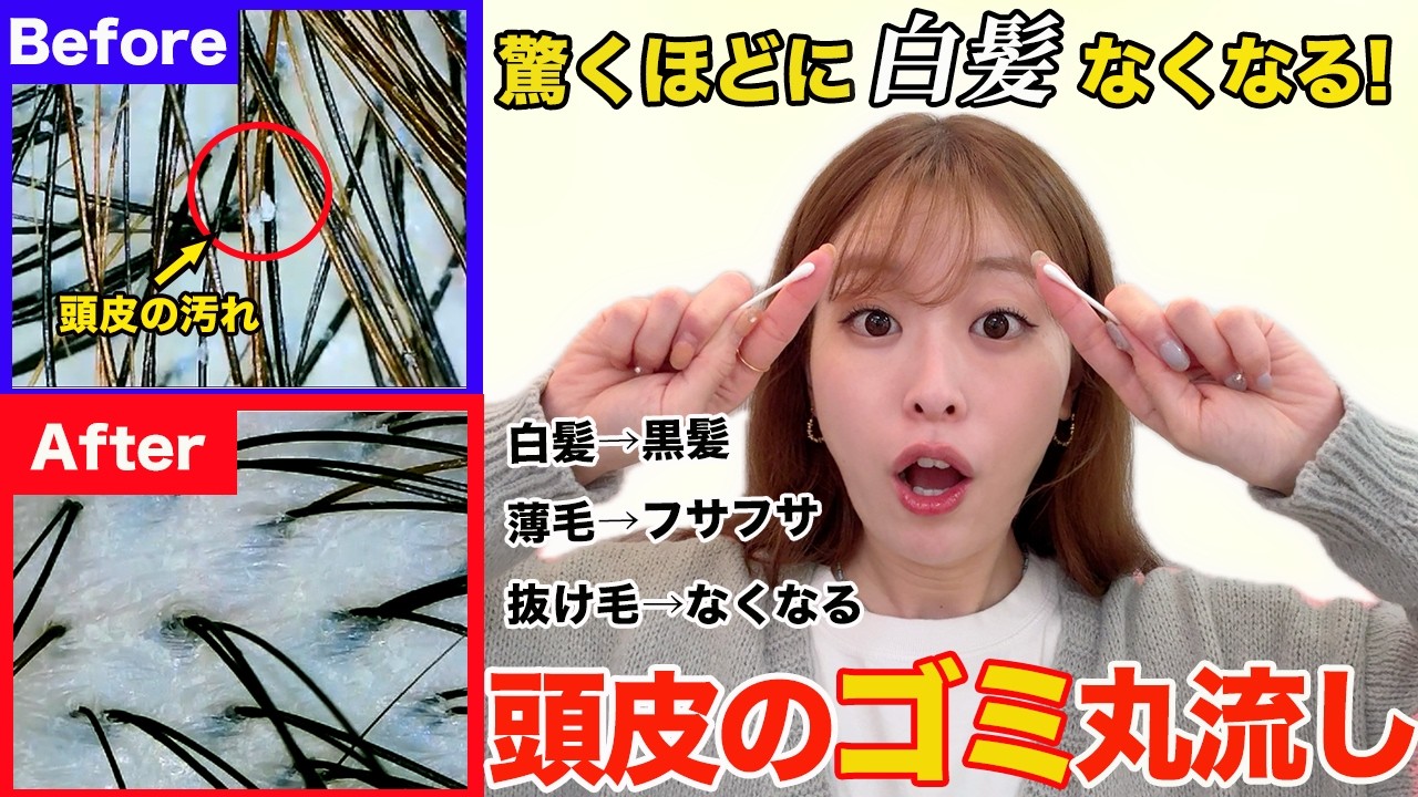 【白髪改善】お風呂前の週1回頭皮ケアで白髪がみるみる激減！薄毛,抜け毛や頭皮の嫌な臭いにも効果的な頭皮ケア♡