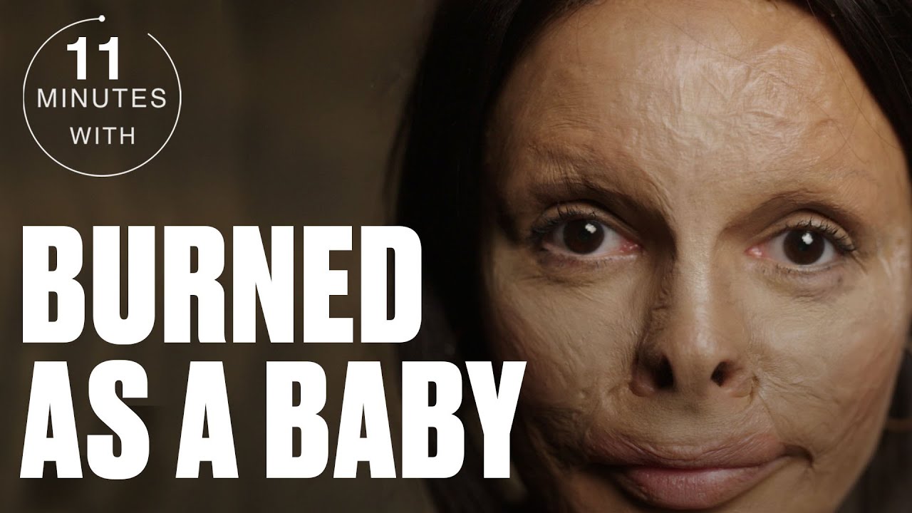 Why I Thought My Mum Tried To Burn Me Alive | Minutes With | UNILAD | @LADbible TV