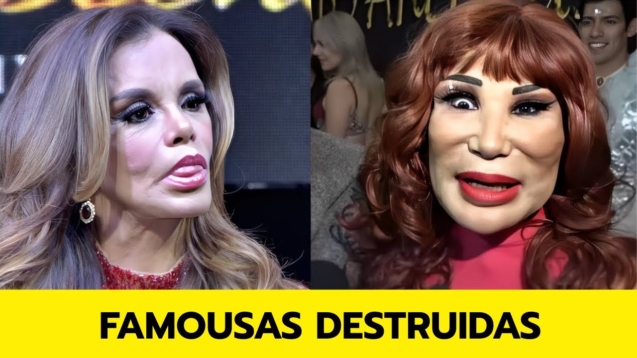 ¡Top 31 TERRIBLES Cirugías Plásticas de Famosos LATINOS! | entonces y ahora 2026