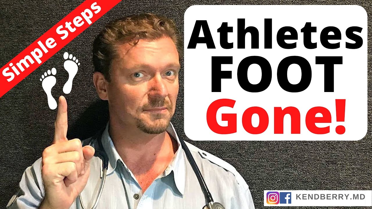 Cure ATHLETES FOOT (Keep it Gone FOREVER) 2024