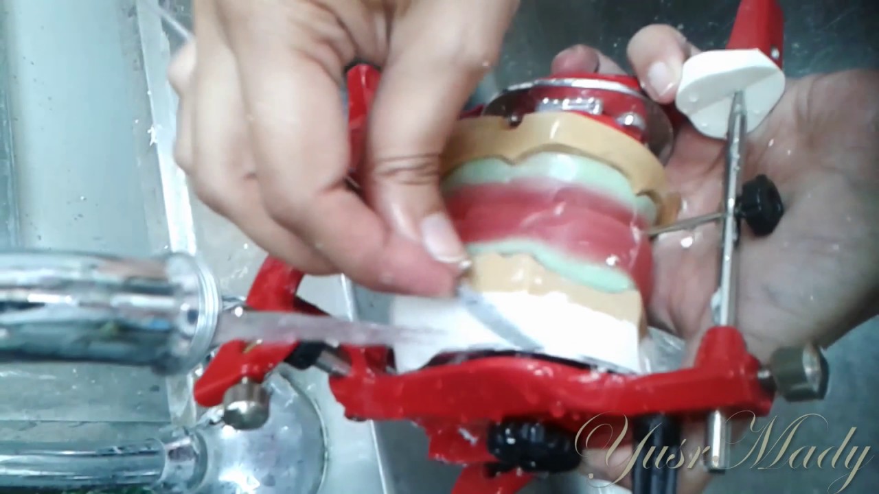3 - Mounting Of Master Casts