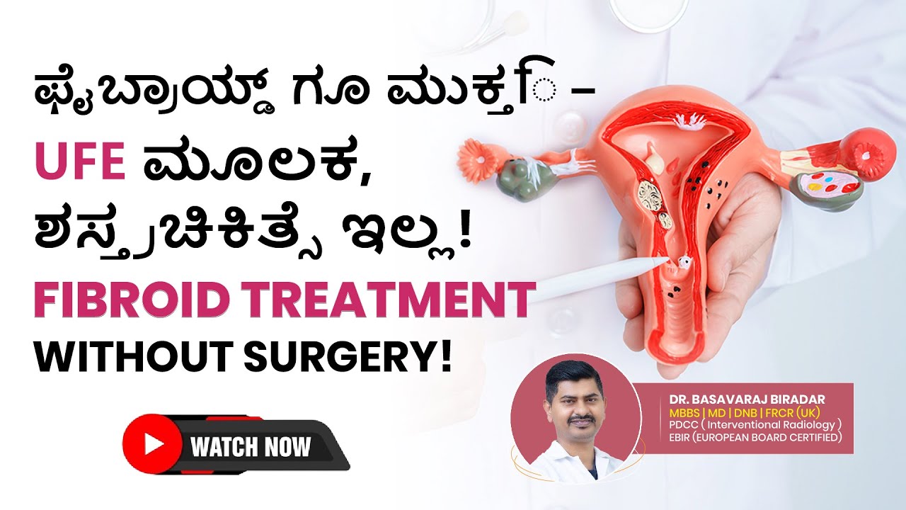 Uterine Fibroid Embolisation(UFE)|A Safe, Non-Surgical#treatment for #fibroids #bangalore #karnataka