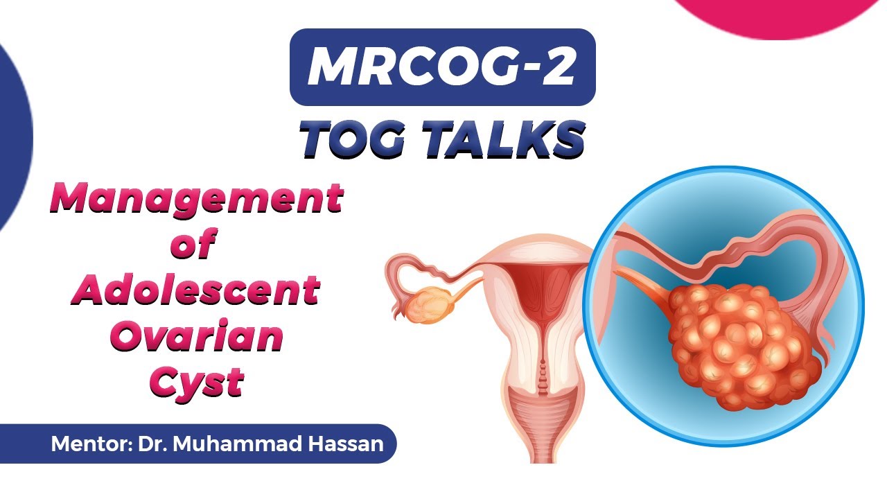 MRCOG 2 TOG TALK | Management of Adolescent Ovarian Cyst | 26-11-2021