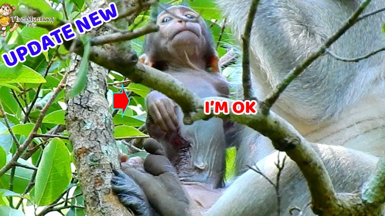 So glad see poor baby Cinn active around her mom, Cinn could a bit raise up her hand, Wish she's OK