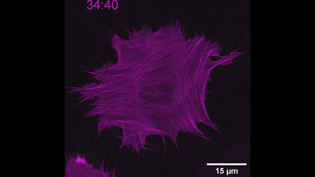 Spreading of cells on a composite of fibronectin and galectin-8