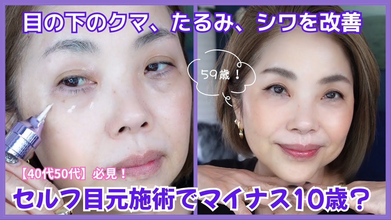 【59歳‼️】セルフ目元施術でマイナス10歳？目の下のクマ、たるみ、シワを改善