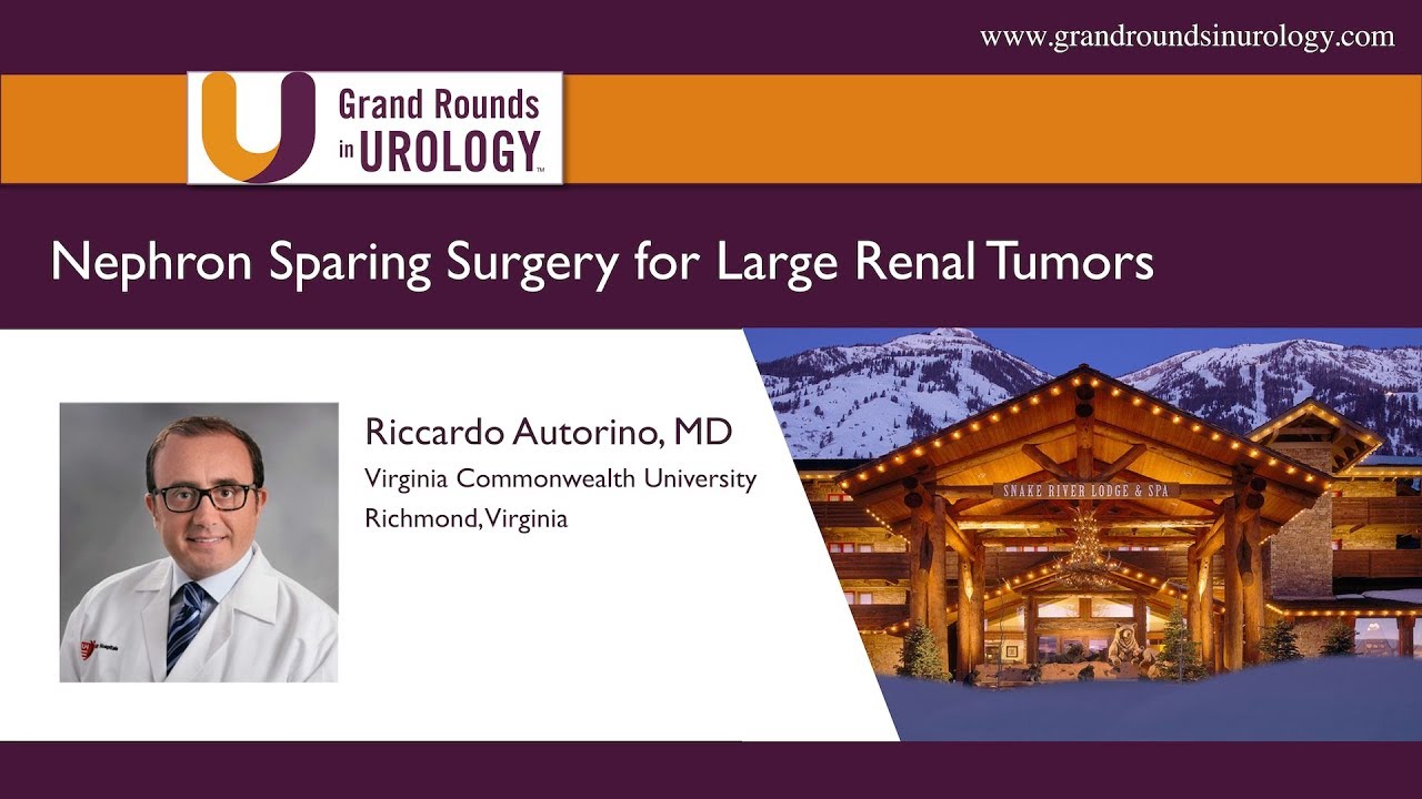 Nephron Sparing Surgery for Large Renal Tumors