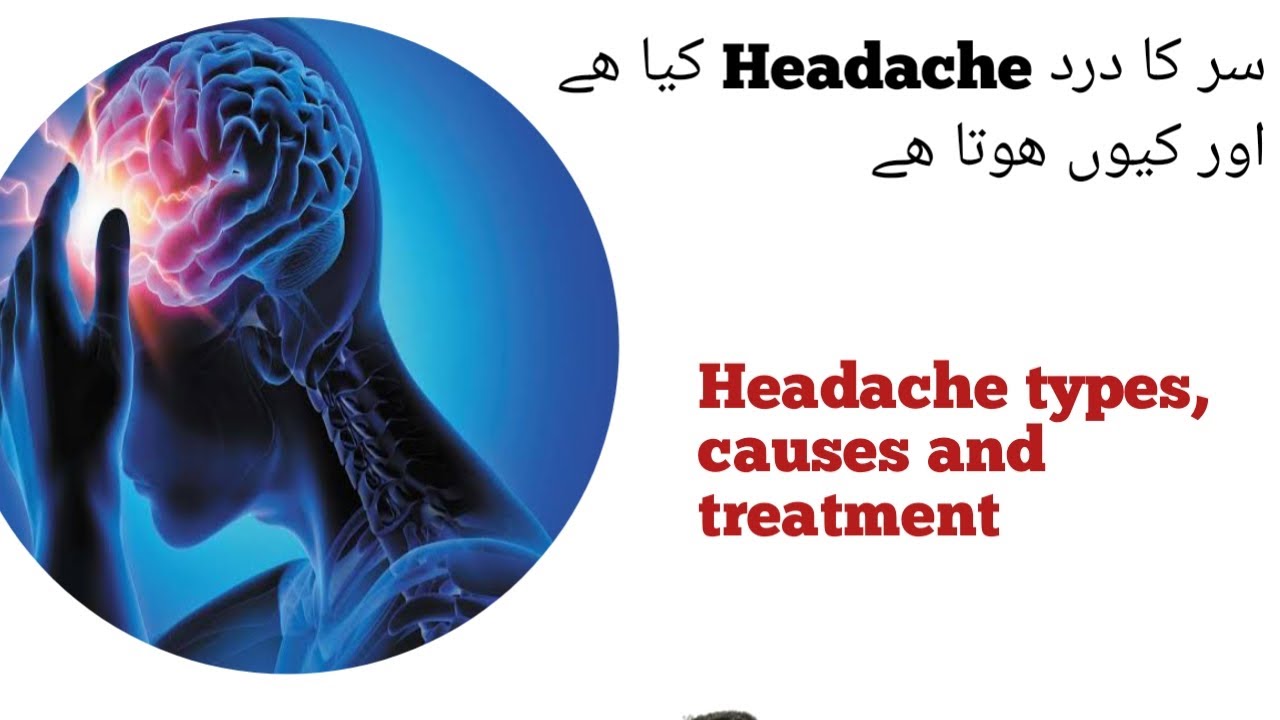 L-20 Headache types causes and treatment