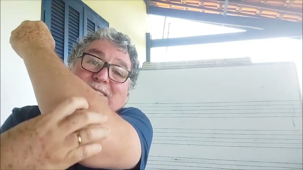 ✅SUPER AGÚDOS , O SEGREDO DA EMBOCADURA DE CIMA E DE BAIXO PARA DOMINAR TODOS  SUPER AGUDOS NO SAX