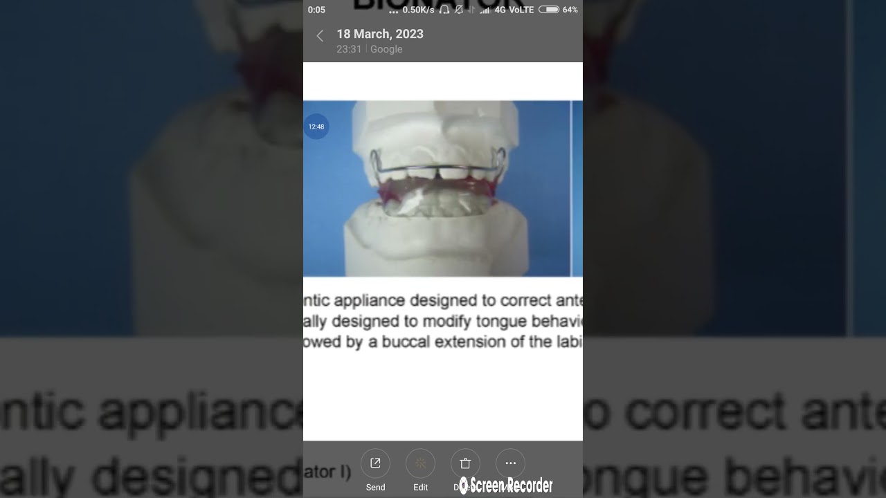 Orthodontics Synopsis Part8 |bionator,cybernator,propulsor,camouflage tech, Retention app #synopsis