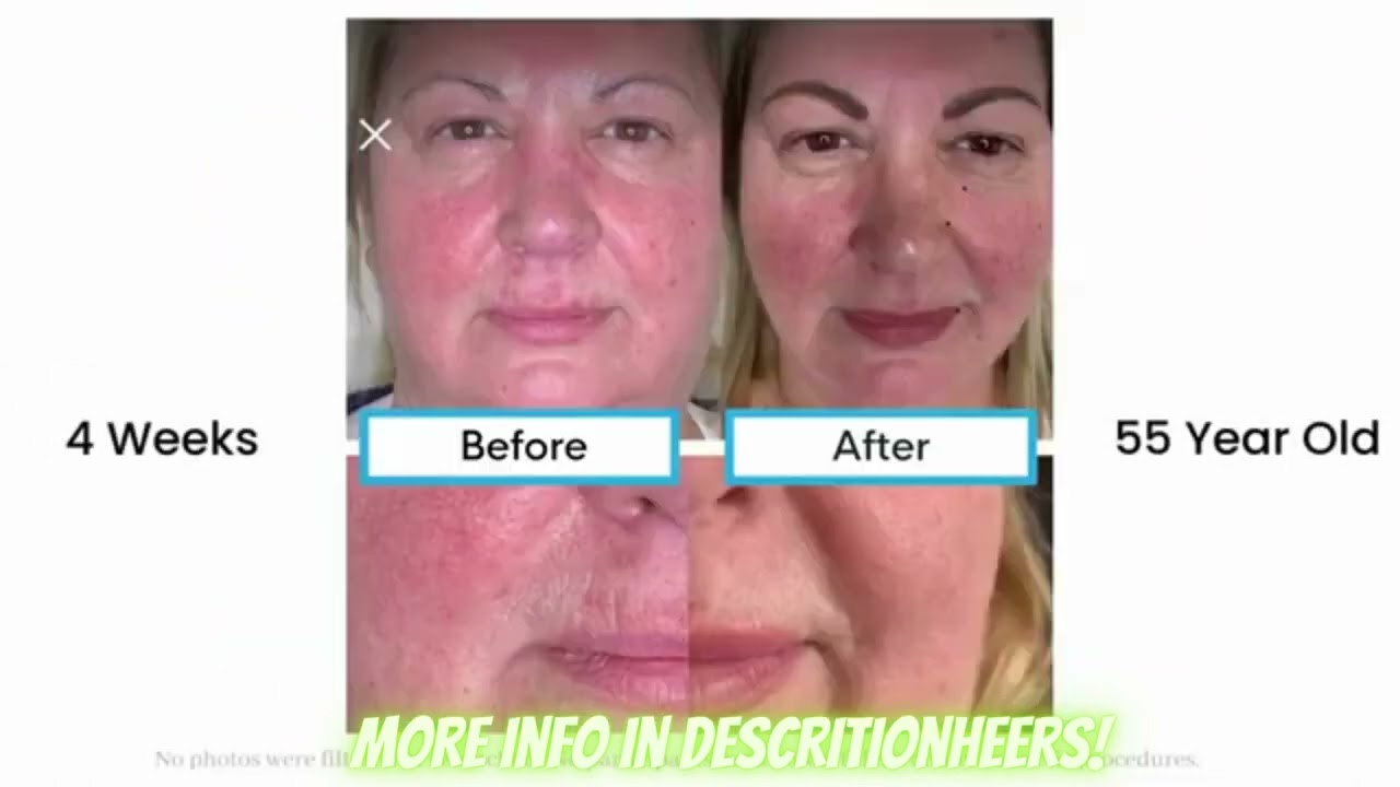 Skin&rsquo;s breakthrough technology.