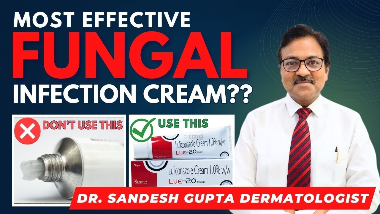 Fungal infection होने पर कौन सी cream लगाएँ । (Only for MBBS Doctors) by Expert Dr Sandesh Gupta.