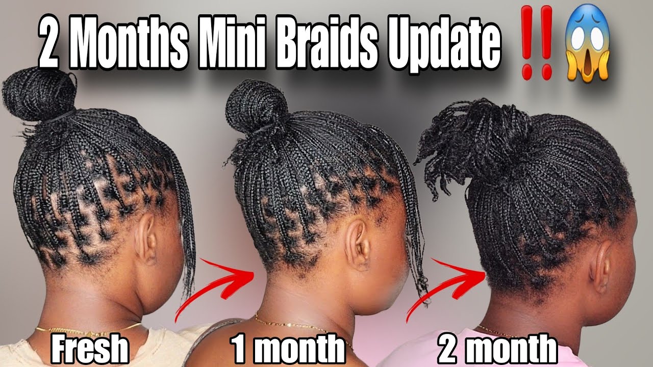 AUG 6: 2 Months Mini Braids UPDATE On 4c Hair ‼️😱*WHAT!!!*