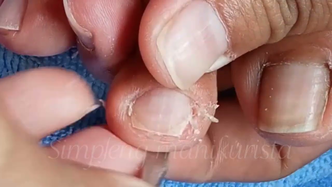 Ang ganda linisan, makapal ang dry skin at cuticle 😱
