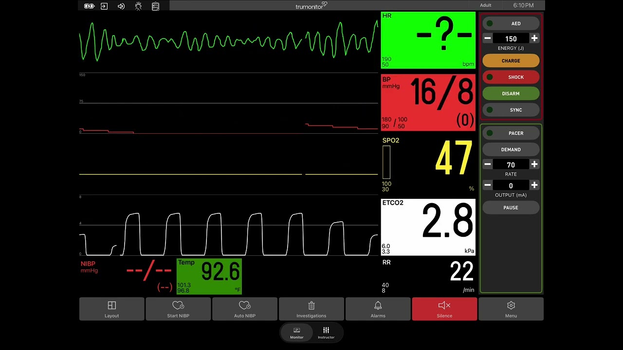 Heart Attack (App: Trumonitor)