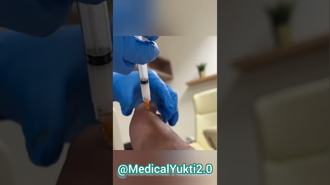 Orthopedic Department 🥰😍🧑&zwj;⚕️ #mbbslife #nurse #healthylifestyle #nursing #medicalprofession
