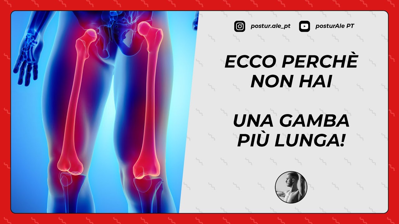 BACINO DISALLINEATO? ECCO PERCHÈ NON HAI UNA GAMBA PIÙ LUNGA!