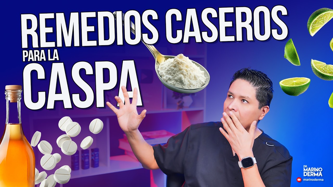 REMEDIOS CASEROS PARA CASPA || Consejos de un dermat&oacute;logo