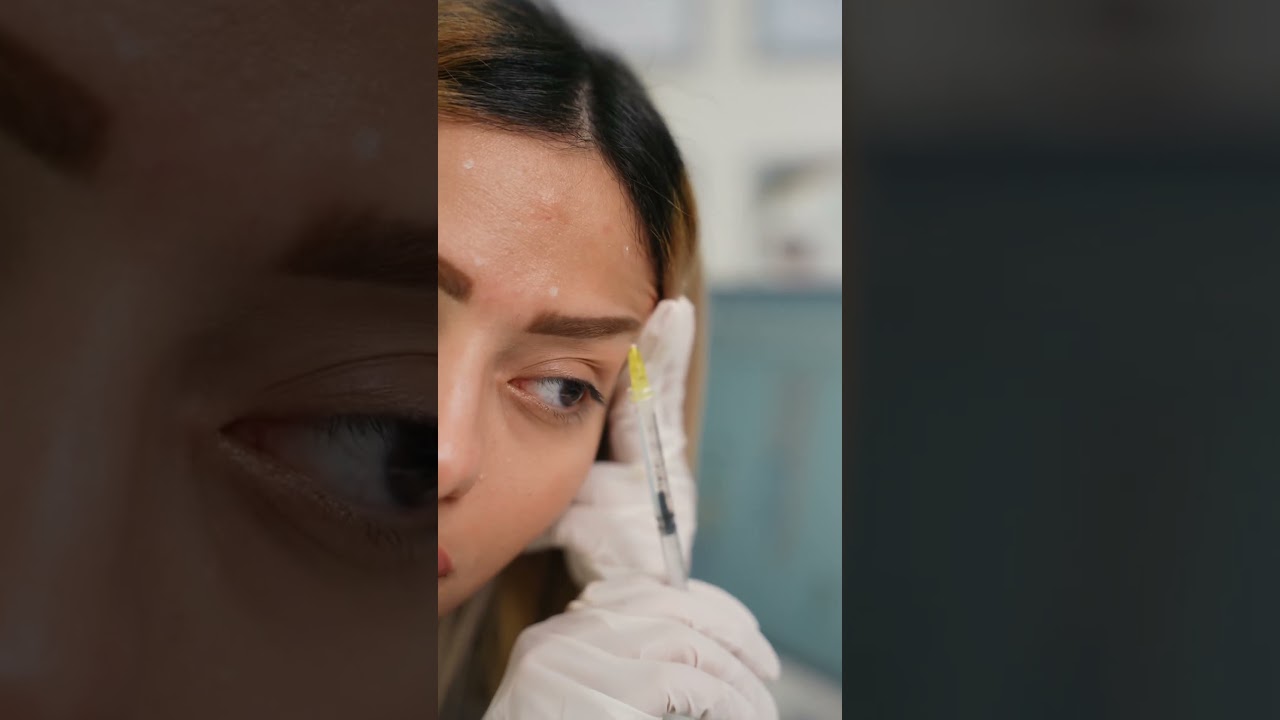 #botox