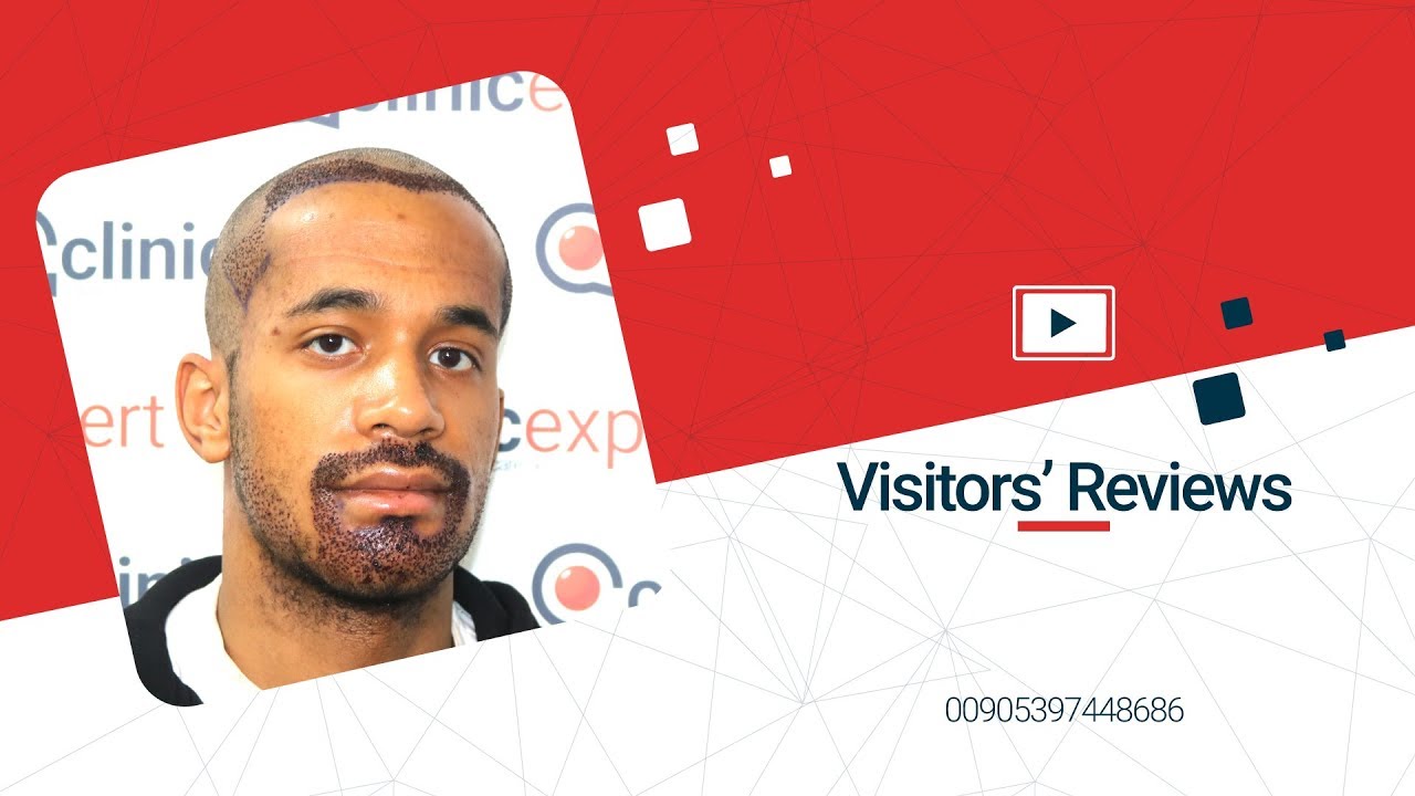 Hair Transplant In Turkey at Clinicexpert - Visitor's Review