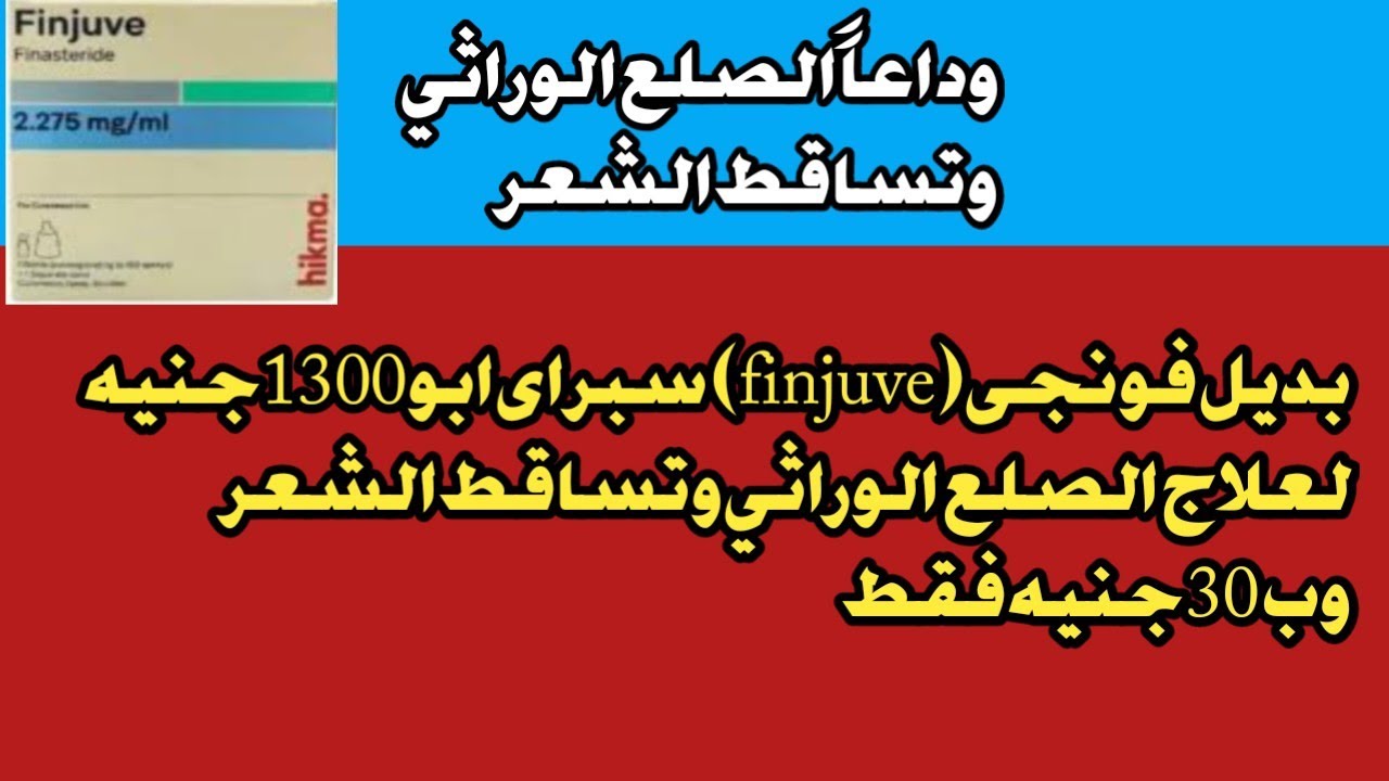 قرار بإلغاء الصلع الوراثي / ازاى تعمل فونجى (Finjuve) سبراى ابو 1300 فى البيت وب30 جنيه فقط 